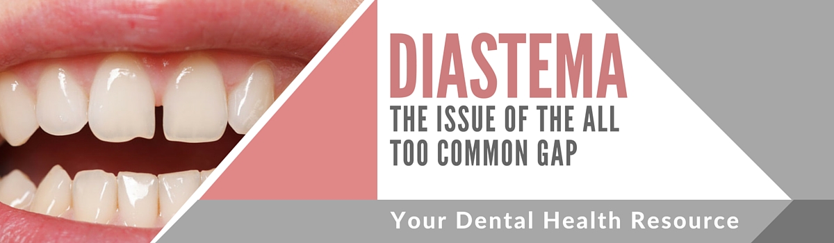 diastema