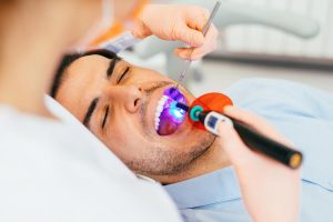 What Happens When I Visit the Dentist for a Hole in Tooth